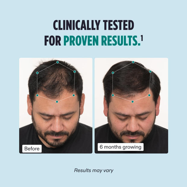 Nutrafol Men Hair Growth Supplement for Thicker