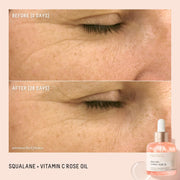 Squalane and Vitamin C Rose Oil