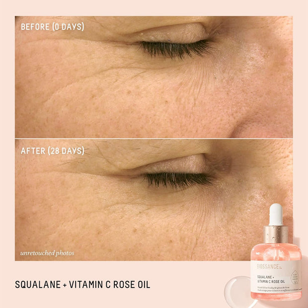 Squalane and Vitamin C Rose Oil